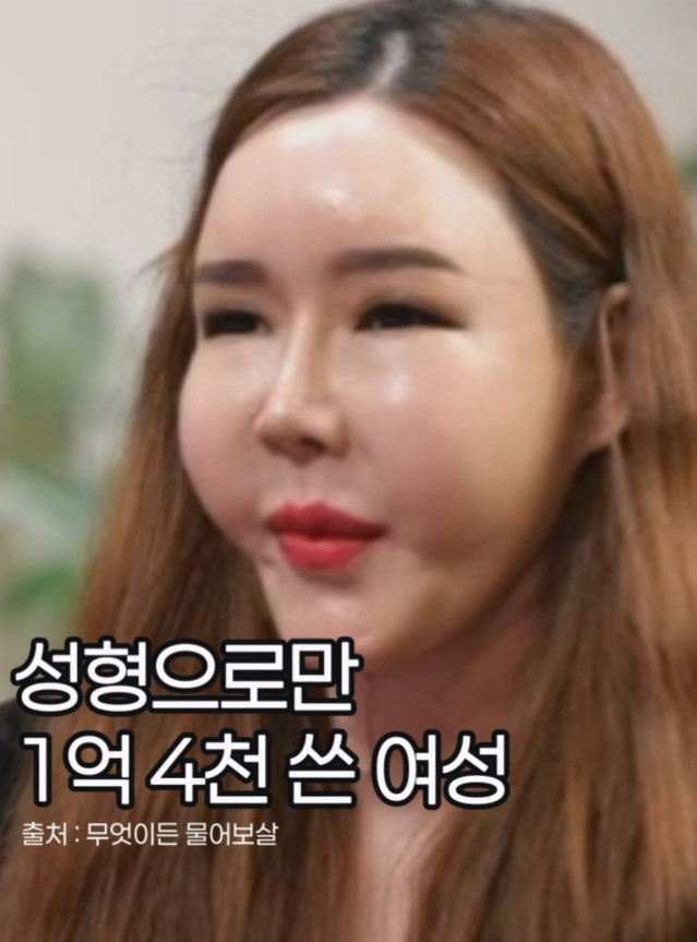 성형에다가 1억을 …. ㄷㄷㄷ