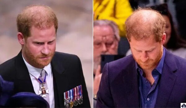 i1474284563.jpg 'LA다저스 모자 논란'.... 英 해리 왕자 '공식 사과'